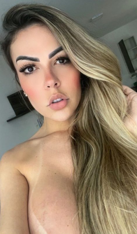 Paula Prado - Operada 5