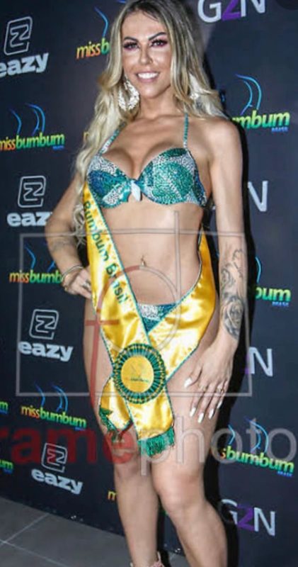 Paula Prado - Operada 29