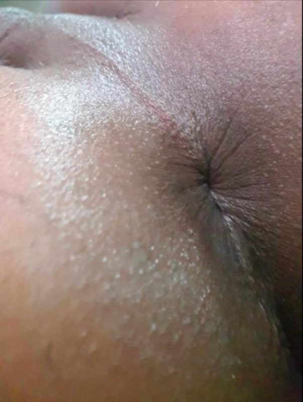 Kauanny Bacck 2