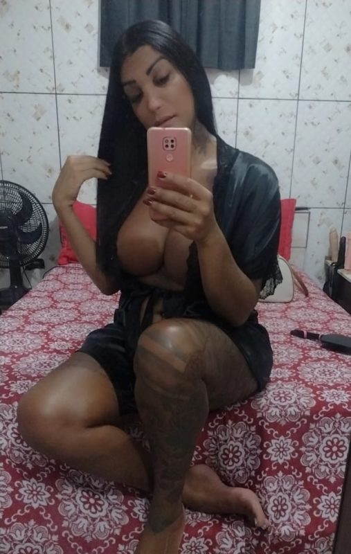 Nicole Ferreira - Operada 3