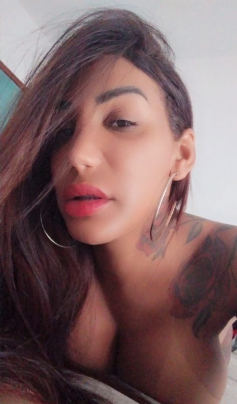 Nicole Ferreira - Operada 1