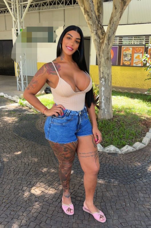 Nicole Ferreira - Operada 3