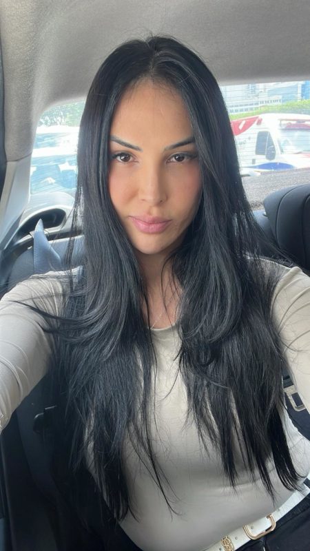 Natalia - Operada 11