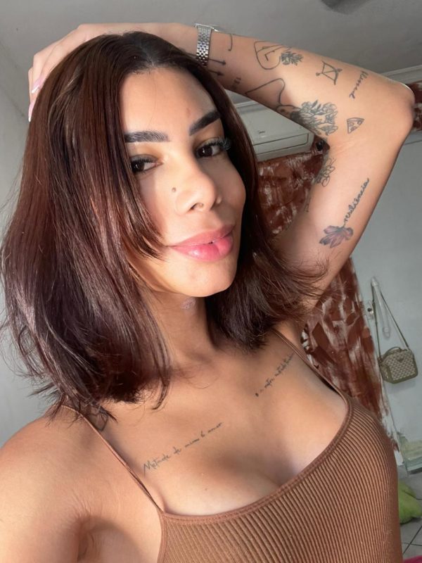 Luna Lacerda - Operada 6
