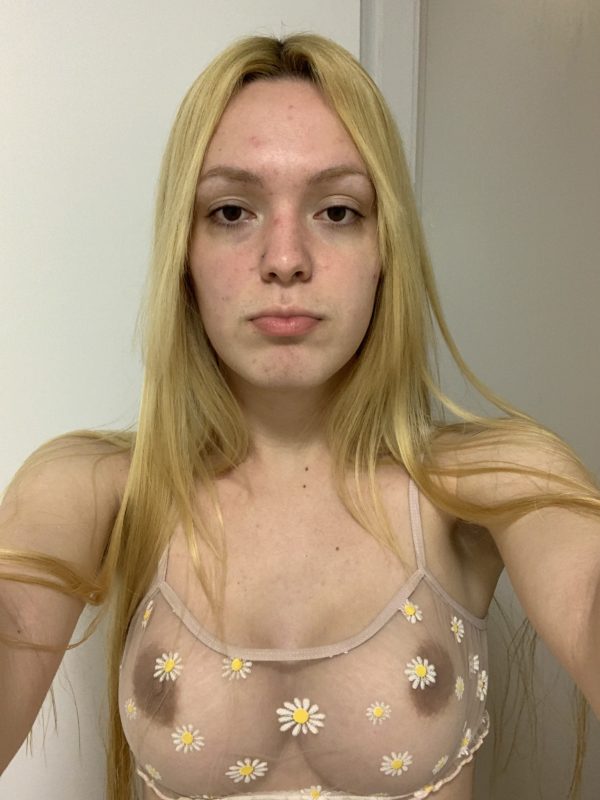 Lice Babe 2